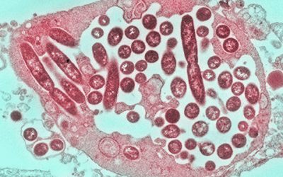 Alerta Legionela: Medidas Preventivas para clínicas