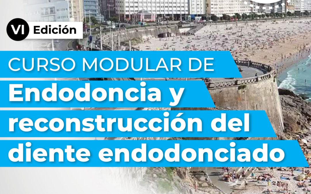 Endodoncia moderna: un curso modular para ir más allá