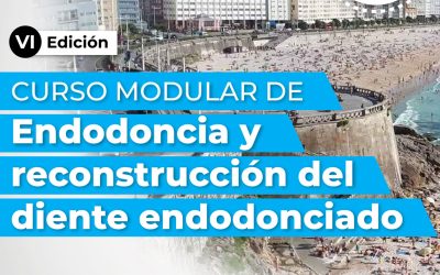 Endodoncia moderna: un curso modular para ir más allá